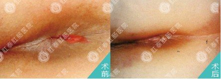 冯女士治疗前后对比图