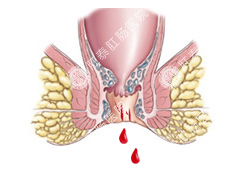 患了便血我们要怎么办呢