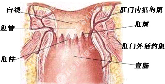 肛瘘是怎么回事呢