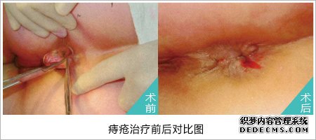 福州肛肠医院