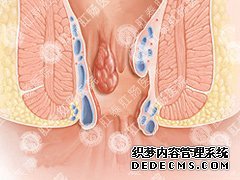 福州肛肠医院