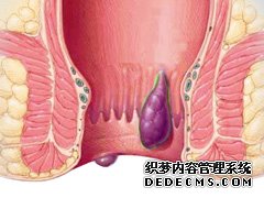 福州肛肠医院 福州医博肛肠医院 福州看痔疮的医院 福州肛瘘医院 福州肛裂医院 福州肠炎医院