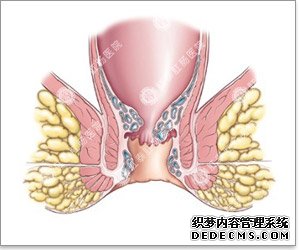 福州肛肠医院 福州医博肛肠医院 福州看痔疮的医院 福州肛瘘医院 福州肛裂医院 福州肠炎医院