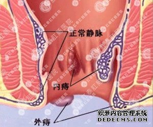 福州肛肠医院