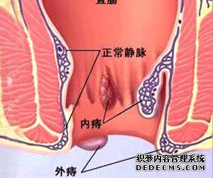 福州肛肠医院 福州医博肛肠医院 福州看痔疮的医院 福州肛瘘医院 福州肛裂医院 福州肠炎医院