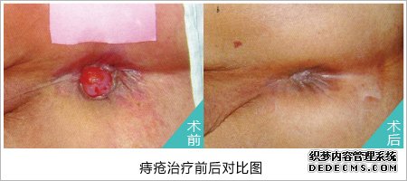 福州肛肠医院
