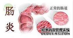 福州肛肠医院 福州医博肛肠医院 福州看痔疮的医院 福州肛瘘医院 福州肛裂医院 福州肠炎医院