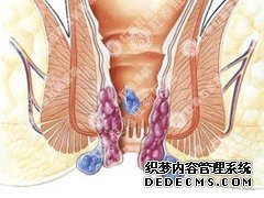 福州肛肠医院