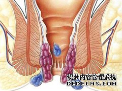 福州肛肠医院 福州医博肛肠医院 福州看痔疮的医院 福州肛瘘医院 福州肛裂医院 福州肠炎医院