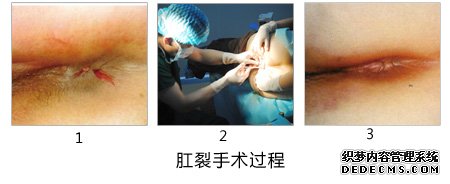 福州肛肠医院